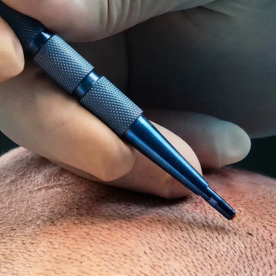 Sapphire FUE Hair Transplant